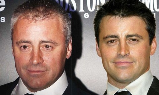 matt leblanc hair loss alt