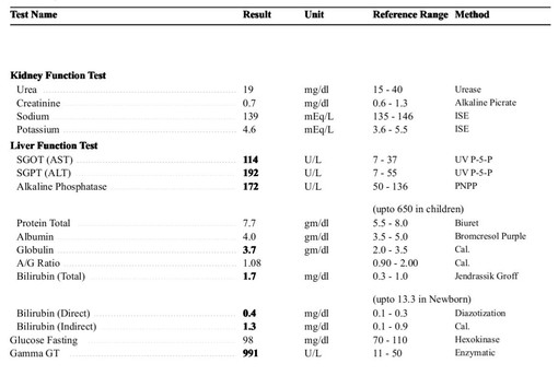 nearly new vauxhall corsa alt